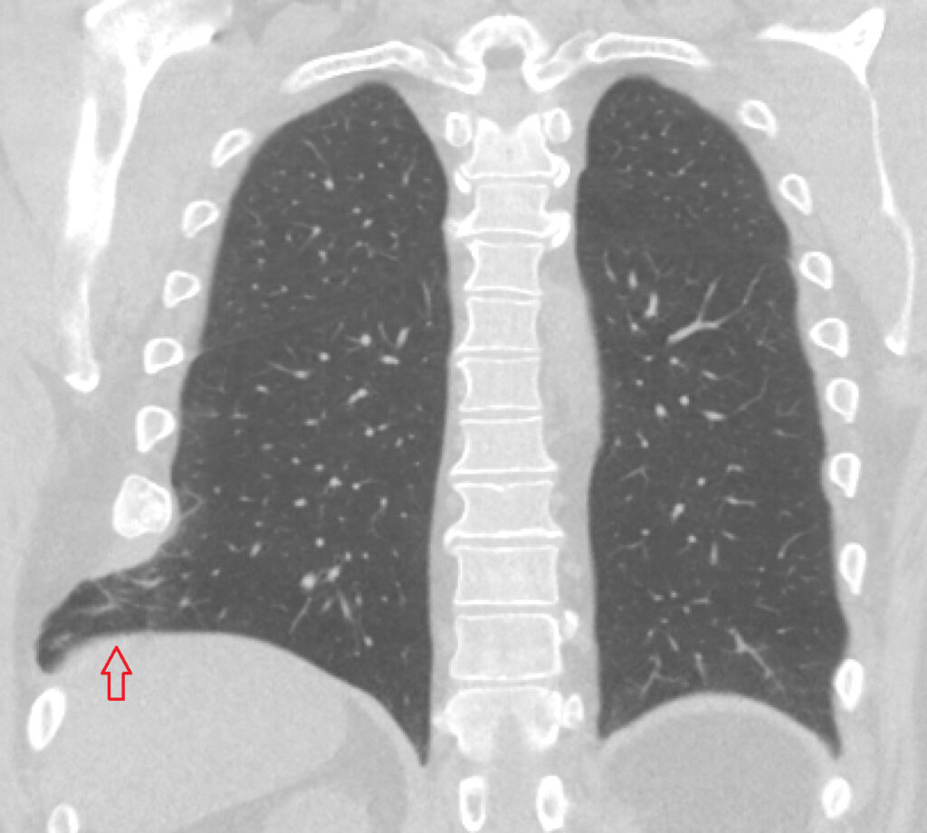 In Abnormality Hrudn ka Medic na A Chirurgia in-abnormality-hrudn-ka-medic-na-a-chirurgia